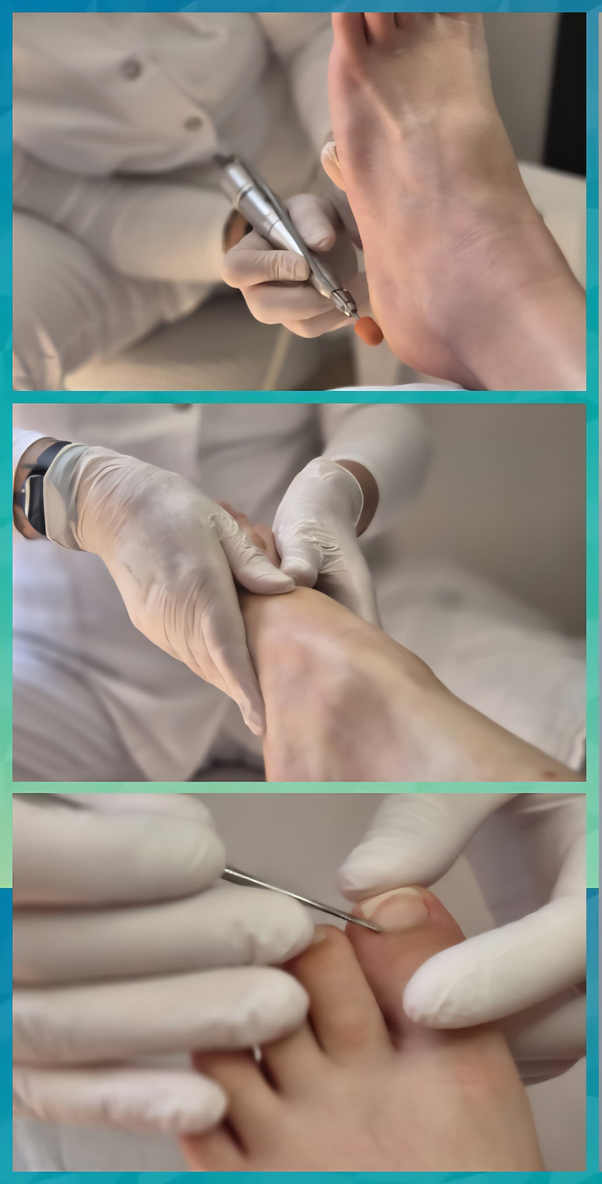 Behandeling pedicure
